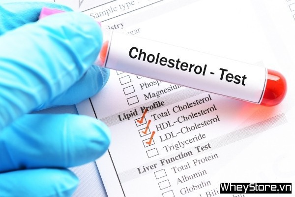 10 cách giảm mỡ máu cholesterol phòng trừ tai biến hiệu quả - Ảnh 5