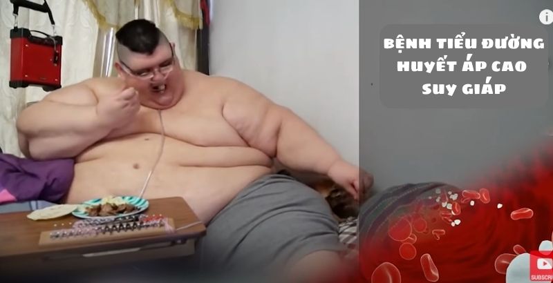 Béo phì ảnh hưởng nghiêm trọng đến sức khỏe 